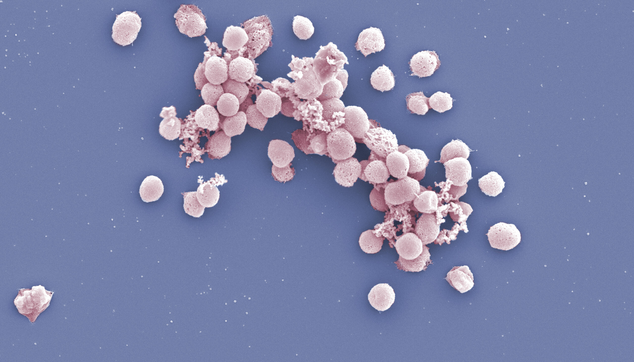 a cluster of round, pink blobs against a sky-blue background