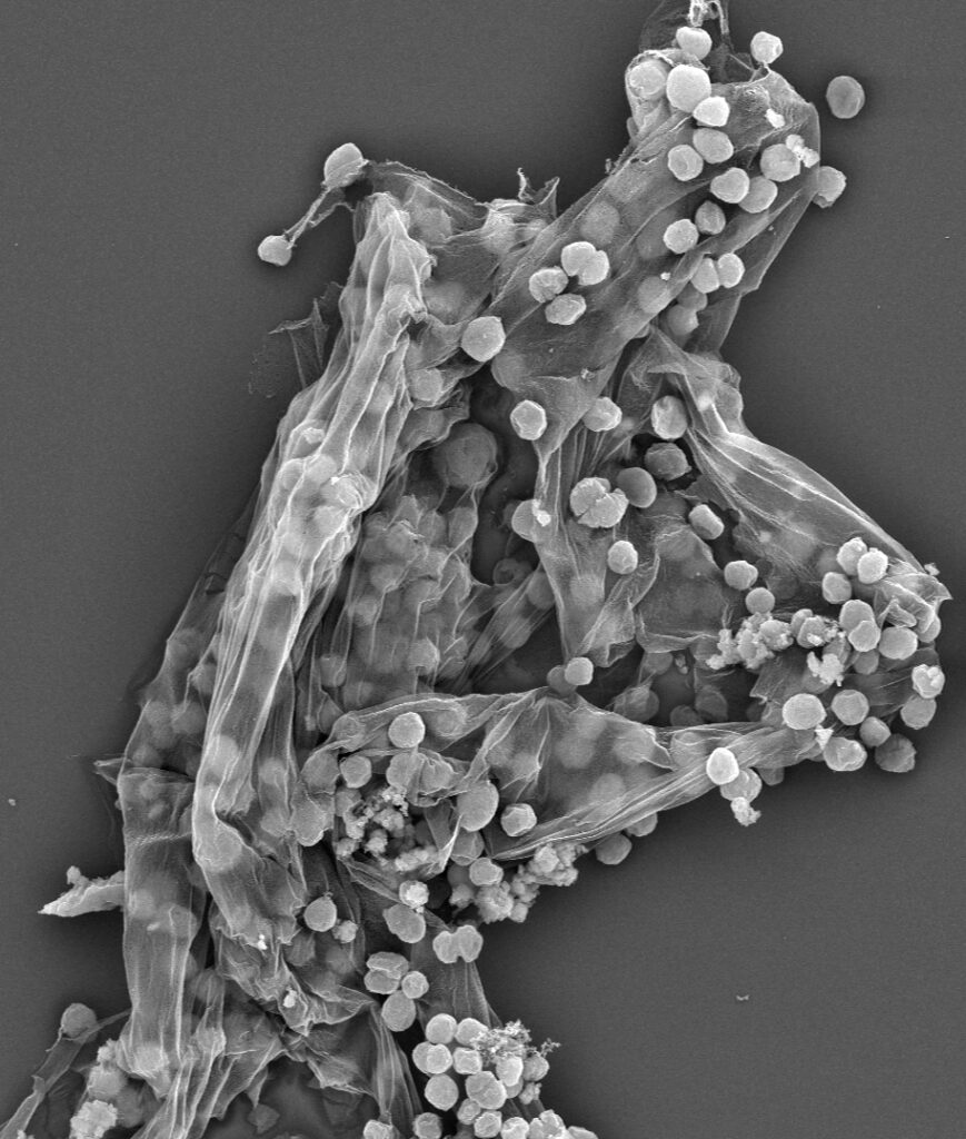 black and white image of round fluffy blobs arranged around a gossamer sheet of tissue