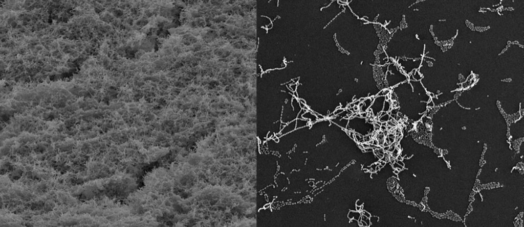 black and white fuzzy stuff next to a black and white closeup showing clumping white blobs